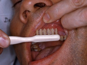 A Clínica também realiza tratamento para sequelas nos dentes permanentes