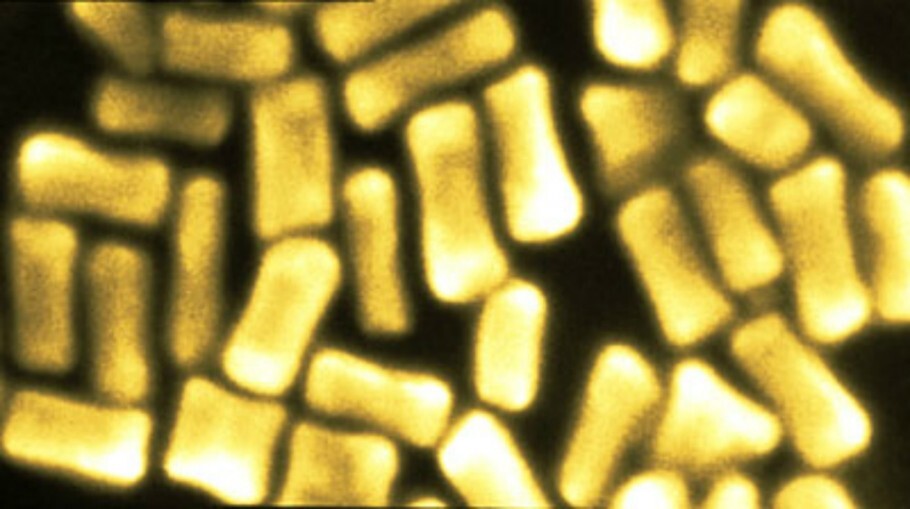 nanobalas de ouro A fototerapia térmica é um método promissor de combate ao câncer, mas esbarra em algumas dificuldades. A pesquisa do jovem Arjun Nair, de 16 anos, tenta criar uma “nanobala” de ouro mais eficiente para o co,bater as células cancerosas.