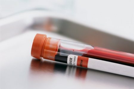 Exames de sangue regulares ajudam na prevenção