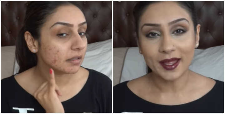 Atriz ensina tutorial perfeito para disfarçar acne com ajuda de