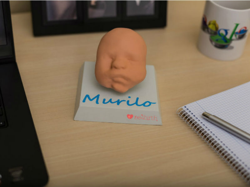 Startup Transforma Ultrassom Em Bebes Impressos Em 3d