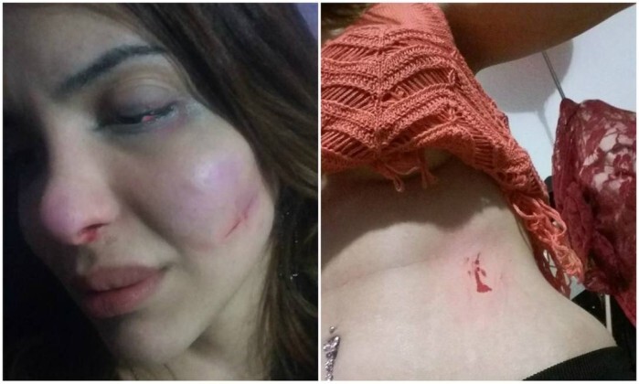 No Facebook, a mulher trans relatou agressões físicas que sofreu