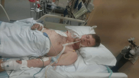 Rapaz durante coma induzido