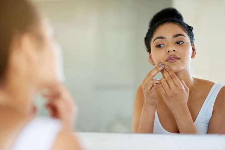 O estresse favorece o surgimento de acne, alergias e infecções