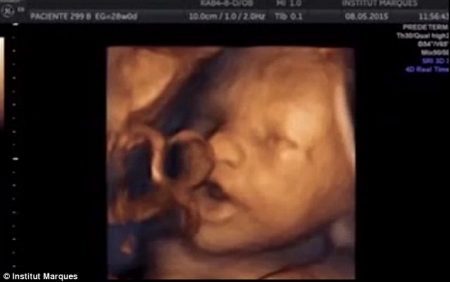 As reações dos bebês a música foram documentadas em exames de ultrassom