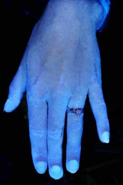 Ainda nota-se alguns pequenos pontos isolados de manchas brancas de bactérias na mão de Jeannie