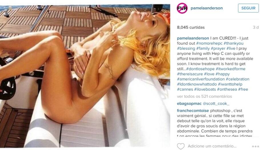 Pamela Anderson publica foto para comemorar cura da doença