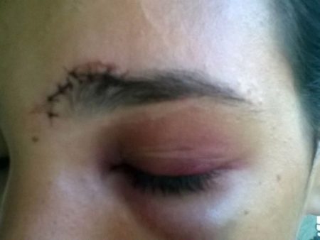 Ludmylla, nutricionista de 27 anos, foi agredida após defender sua irmã de assédio