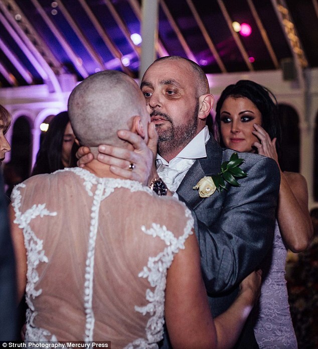 Joan Lyons raspou a cabeça no dia de seu casamento para homenagear noivo com câncer terminal