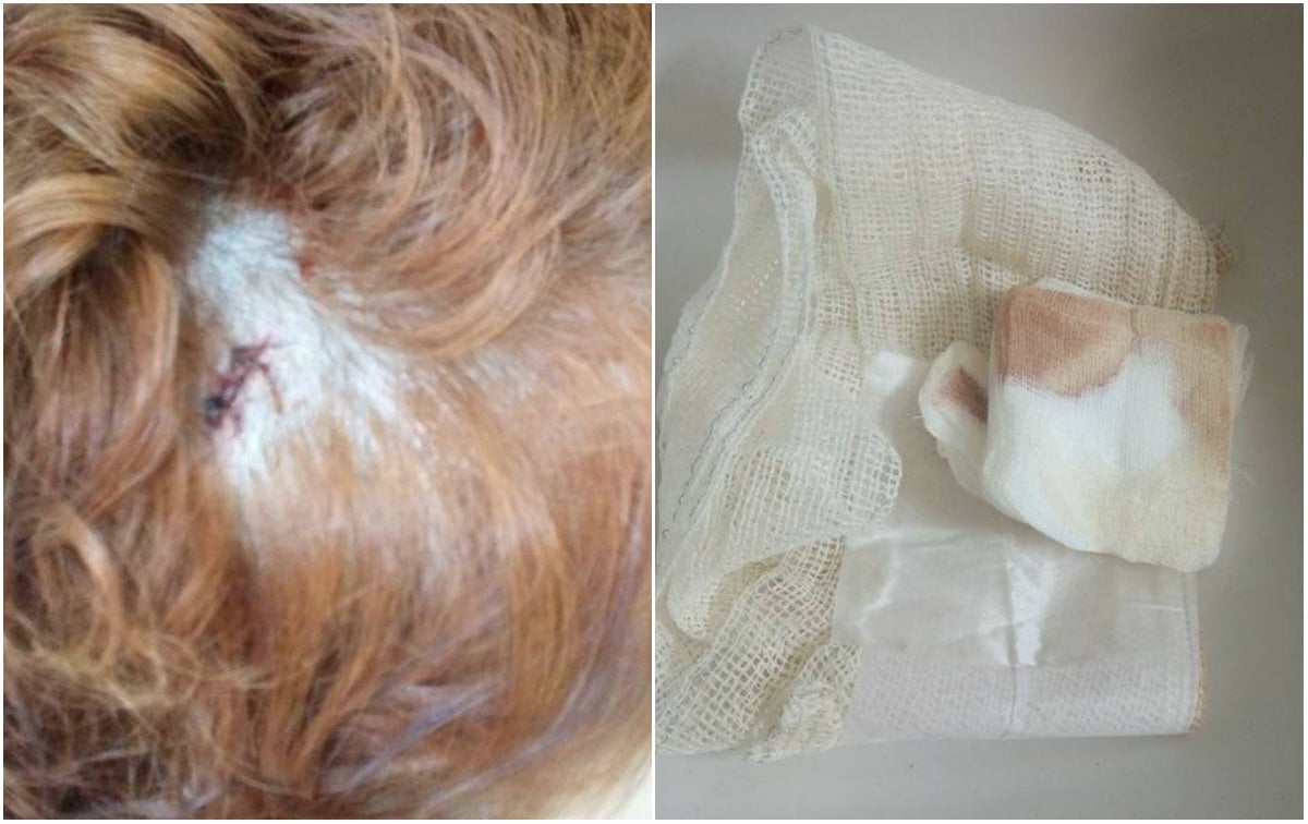 O homem agrediu a vítima na cabeça após ela defender o casal gay