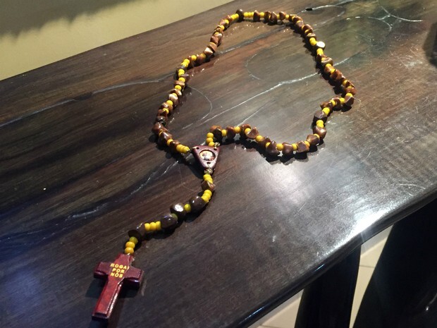 O engenheiro retirou as pedras de sua vesícula há 15 anos