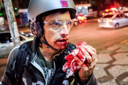 Democracia? Na última quinta-feira, 1, fotógrafo foi ferido na boca por bala de borracha enquanto cobria protesto em SP