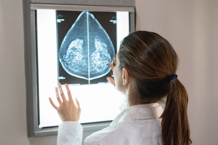 Mamografia pode identificar lesões benignas e nódulos ou calcificações