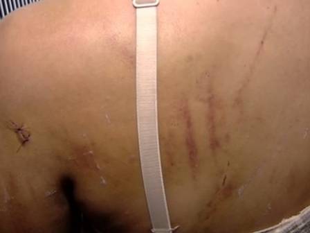 As cicatrizes da agressão