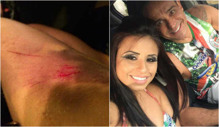 A modelo afirma ter sido agredida por dois homens a mando do ex-marido