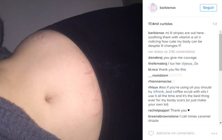 Barbie Ferreira foi criticada após compartilhar foto das estrias