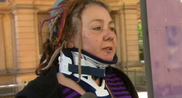 Sharon Hacker afirma que foi salva de ataque pelos dreadlocks