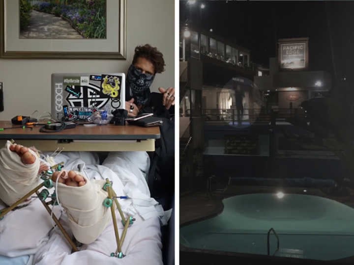 8Booth teve problemas sérios nos pés e pernas