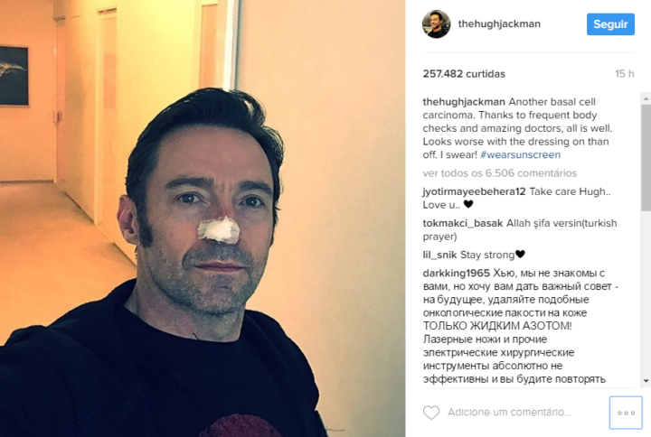 Hugh Jackman retira novo tumor do nariz e comenta nas redes sociais