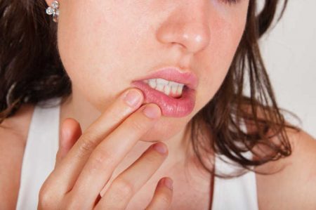 Aprenda a evitar DSTs contraídas pela boca