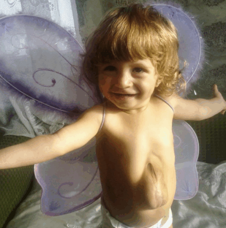 A garotinha aos 15 meses de idade