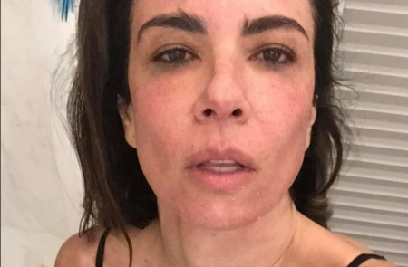 Luciana Gimenez posta foto durante mamografia