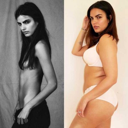 A modelo Liza Golden-Bhojwani postou uma foto no Instagram com um “antes e depois”