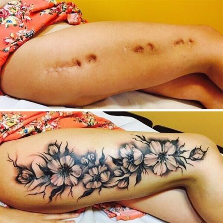 Tatuagens são bastante eficazes para cobrir cicatrizes