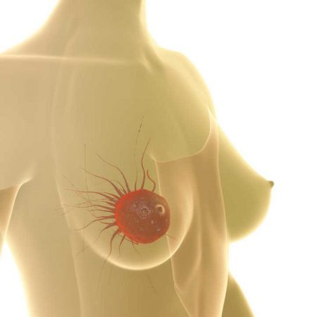 Ano que vem será feito o experimento conclusivo para a da vacina terapêutica contra tumores de mama mais agressivos