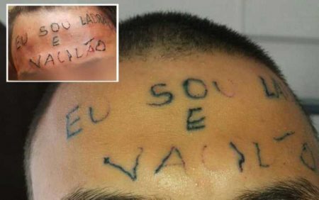 Adolescente que teve testa tatuada passou por primeira sessão para retirada da frase