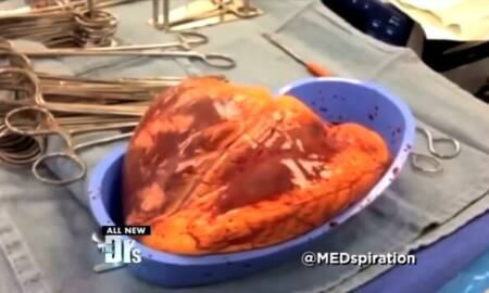 Vídeo inusitado assustou espectadores de programa