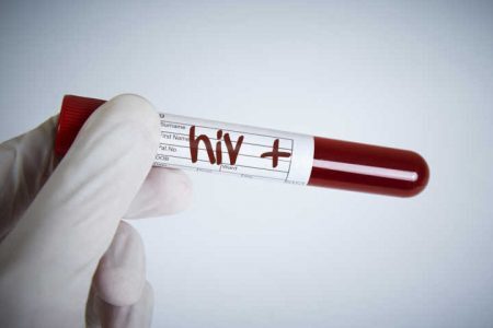 Segundo a Unaids, o número de pessoas com HIV cresce no Brasil