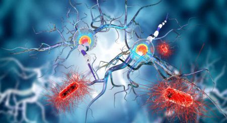 A esclerose múltipla ocasiona a perda de mielina, substância cuja função é fazer com que o impulso nervoso percorra os neurônios