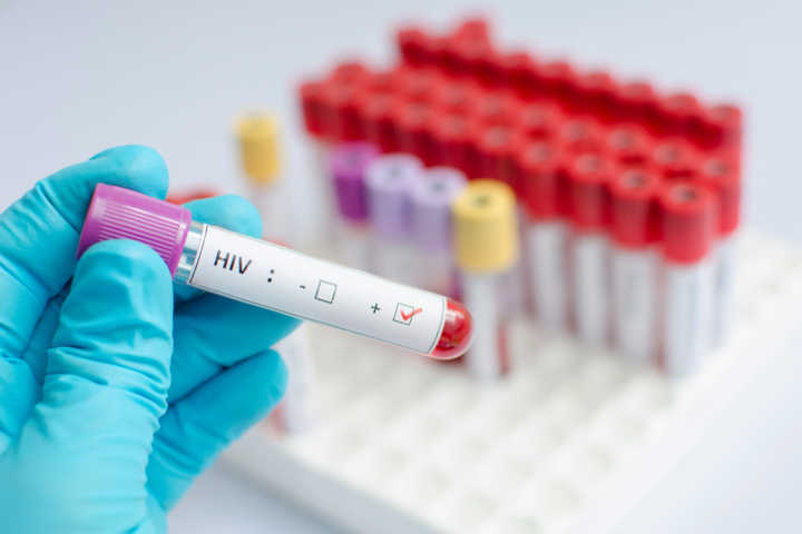 Pesquisa sobre HIV foi encomendada pelo Ministério da Saúde