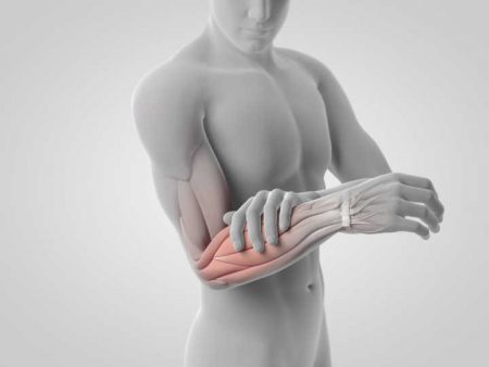 Síndrome causa  dores por todo o corpo durante longos períodos, com sensibilidade nas articulações, músculos, tendões e em outros tecidos