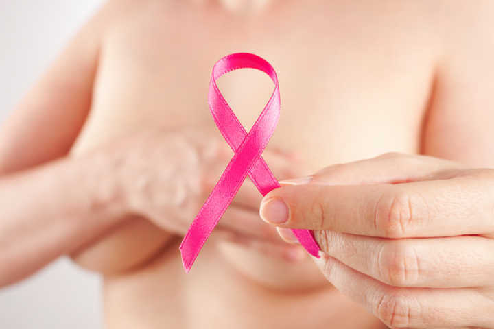 O evento ocorre em prol da difusão de informações sobre o câncer de mama