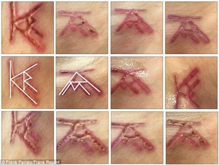 Escravas sexuais de Allison Mack têm iniciais da atriz marcadas na pele
