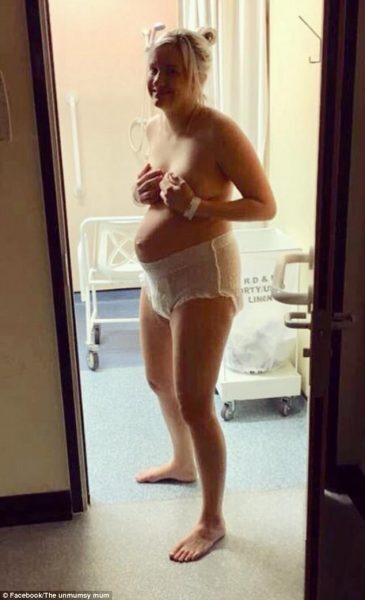 Mãe posta foto para mostrar realidade pós-parto
