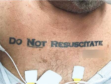 Homem tatua “não ressuscitar” no peito e levanta dilema entre médicos