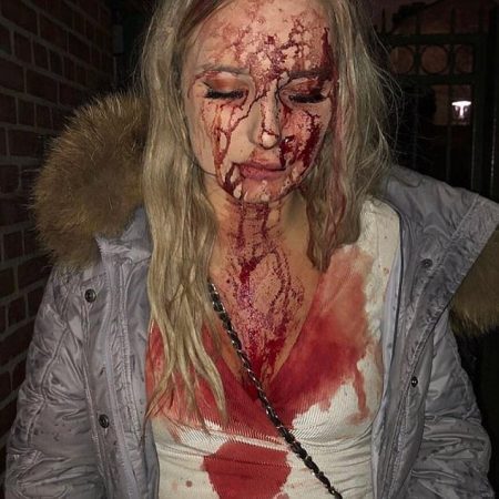 Sophie Johansson foi agredida com garrafa por homem em boate