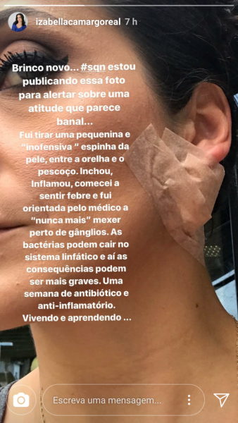 Izabella Camargo mostrou curativo na orelha após espremer espinha