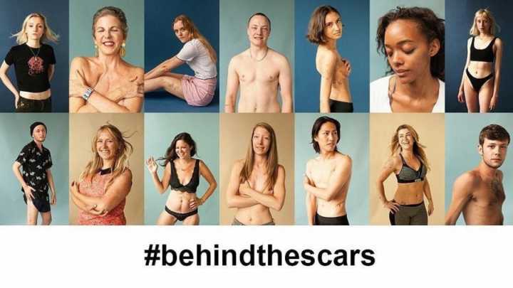 O projeto ‘Behind The Scars’ mostra o que por trás de cicatrizes