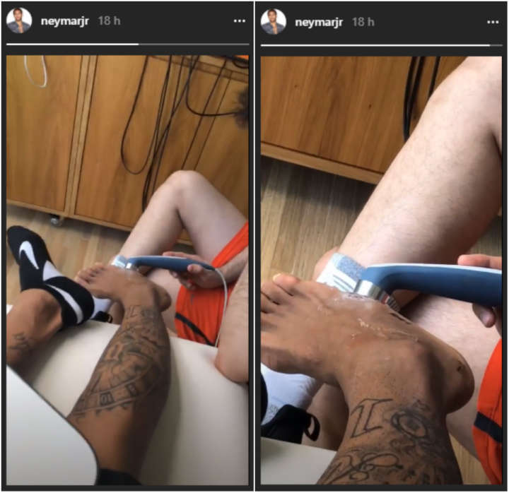 Neymar Jr. mostra imagens do pé direito após cirurgia e tranquiliza fãs