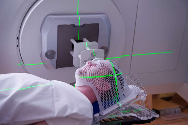 Radioterapia é um dos tratamentos de tumor cerebral