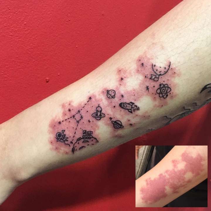 Tatuagem “espacial” feita com marca de nascença no braço