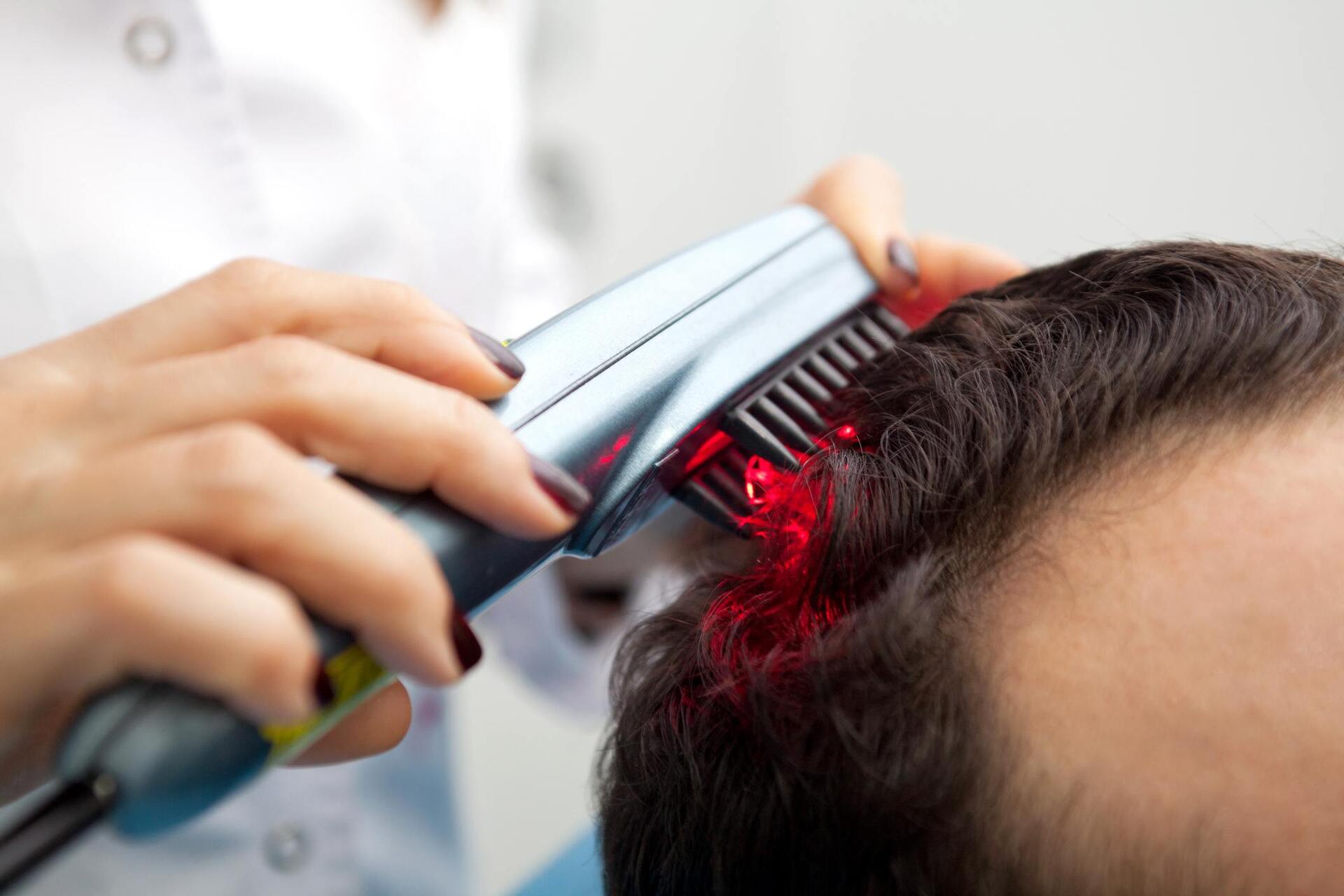 Para quem sobre com queda de cabelo excessiva, tratamentos à laser são boas soluções