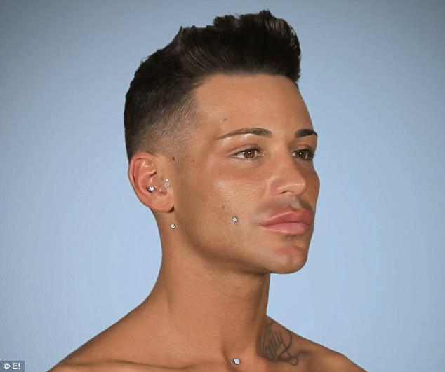 Joey foi ao reality show “Botched”, do canal E!, para corrigir uma “falha” no nariz