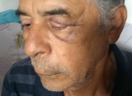 Idoso de 67 anos é agredido por PM no Distrito Federal