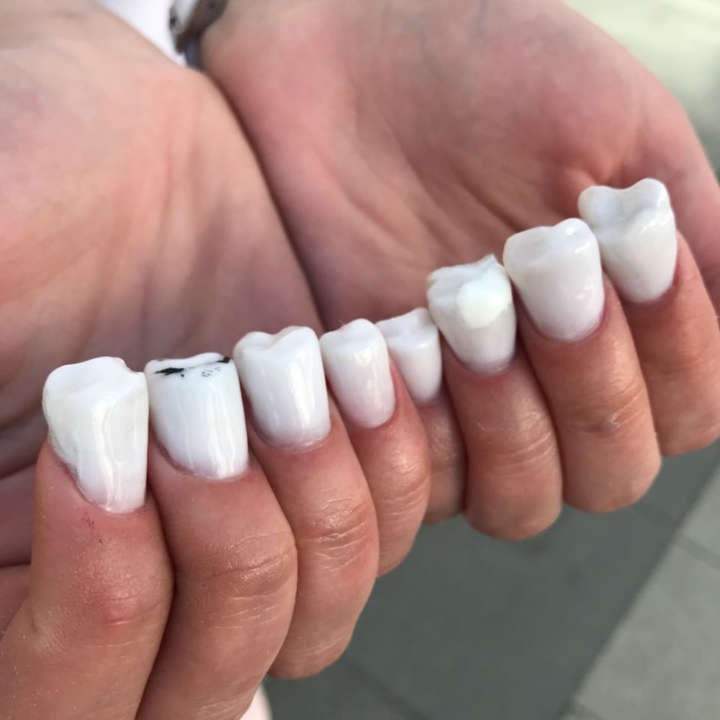 Acha que a quantidade de dentes que você na boca tem não é suficiente? Aí vai uma solução!