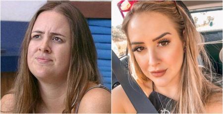 Ex-BBB Patrícia Leitte antes e depois da lipo no rosto